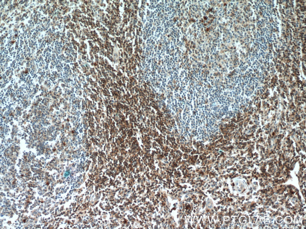 CD3 Gamma Polyclonal antibody