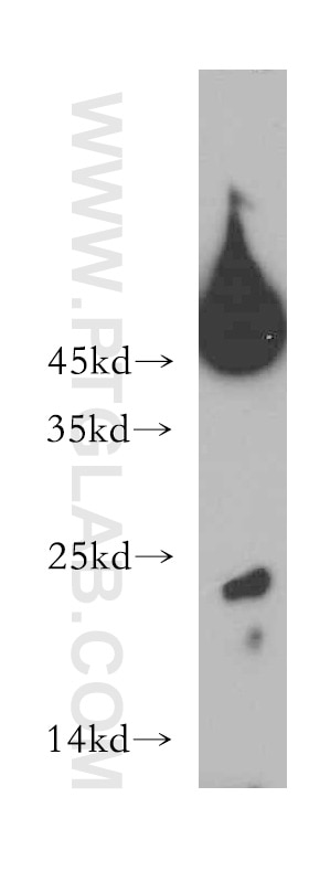 Western Blot (WB) analysis of Jurkat cells using CD3 Gamma Polyclonal antibody (21120-1-AP)