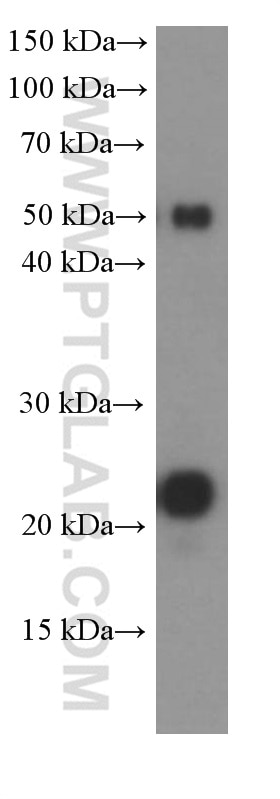 Western Blot (WB) analysis of Jurkat cells using CD3 Gamma Monoclonal antibody (60347-1-Ig)