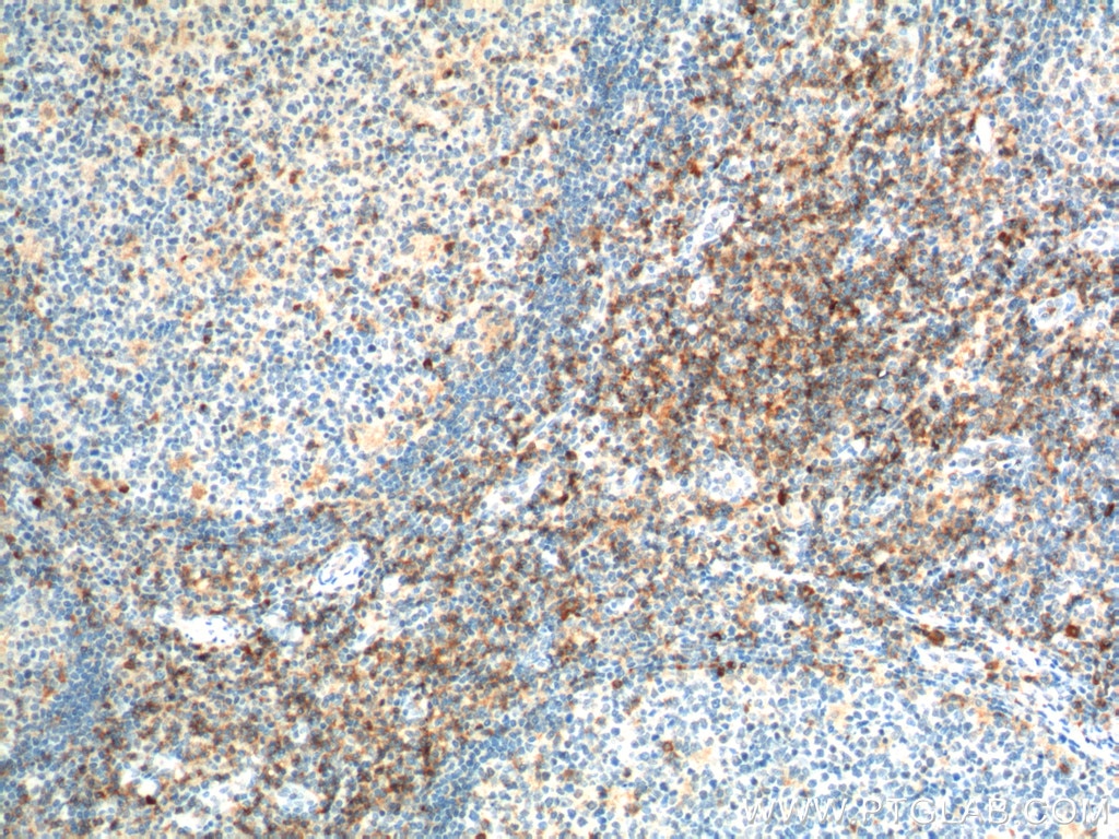 CD4 Polyclonal antibody