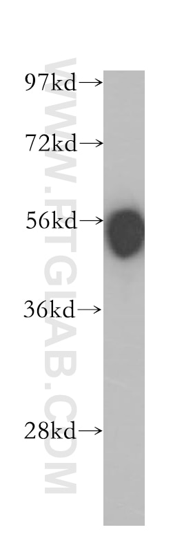 Western Blot (WB) analysis of human spleen tissue using CD4 Polyclonal antibody (11056-2-AP)