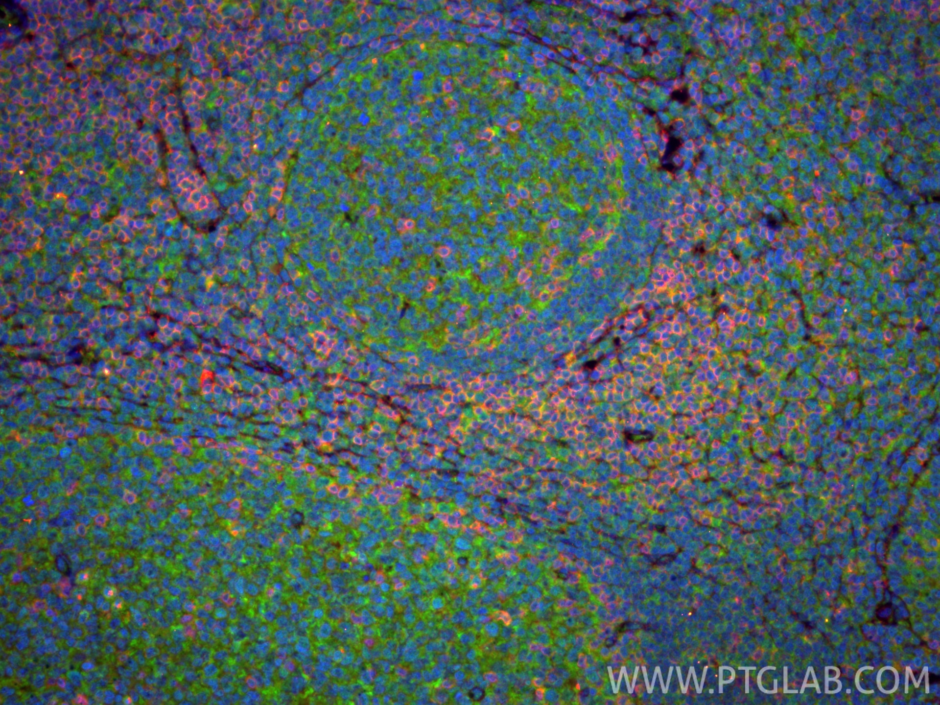 Immunofluorescence (IF) / fluorescent staining of human tonsillitis tissue using CD4 Polyclonal antibody (19068-1-AP)