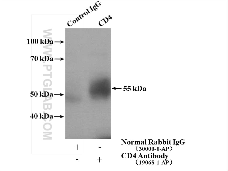 Immunoprecipitation (IP) experiment of mouse thymus tissue using CD4 Polyclonal antibody (19068-1-AP)