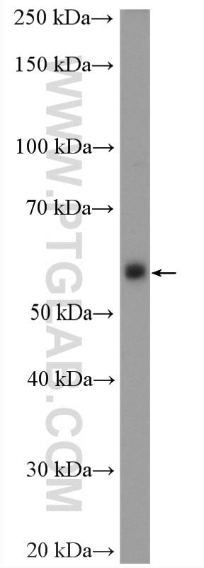 Western Blot (WB) analysis of pig thymus tissue using CD4 Polyclonal antibody (19068-1-AP)