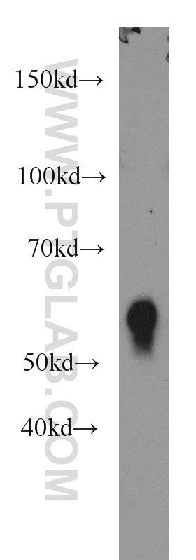 Western Blot (WB) analysis of mouse thymus tissue using CD4 Polyclonal antibody (19068-1-AP)