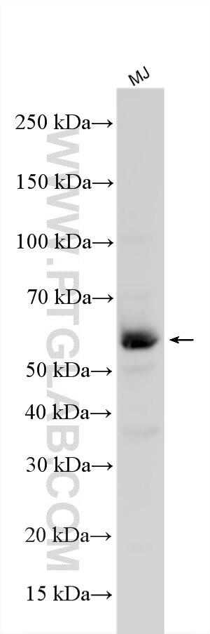 WB analysis using 30566-1-AP Western Blot (WB) analysis of various lysates using CD4 Polyclonal antibody (30566-1-AP)