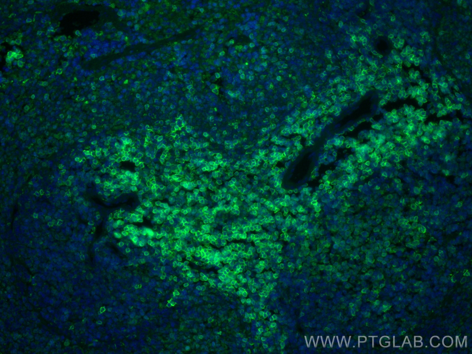 Immunofluorescent analysis of (4% PFA) fixed paraffin-embedded rat spleen tissue using CD4 antibody (32406-1-AP) at dilution of 1:200 and CoraLite®488-Conjugated Goat Anti-Rabbit IgG(H+L) (SA00013-2). Heat mediated antigen retrieval with Tris-EDTA buffer (pH 9.0). Immunofluorescence (IF) / fluorescent staining of rat spleen tissue using CD4 Polyclonal antibody (32406-1-AP)