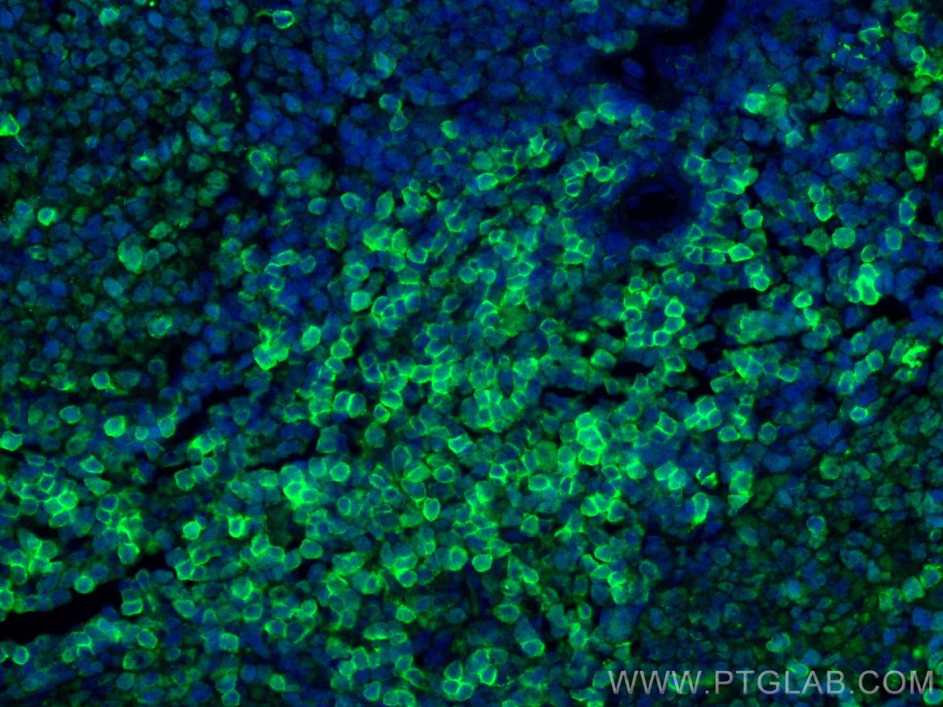Immunofluorescent analysis of (4% PFA) fixed paraffin-embedded rat spleen tissue using CD4 antibody (32406-1-AP) at dilution of 1:200 and CoraLite®488-Conjugated Goat Anti-Rabbit IgG(H+L) (SA00013-2). Heat mediated antigen retrieval with Tris-EDTA buffer (pH 9.0). Immunofluorescence (IF) / fluorescent staining of rat spleen tissue using CD4 Polyclonal antibody (32406-1-AP)