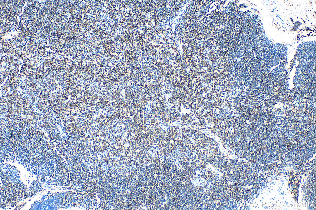 Immunohistochemistry (IHC) staining of rat thymus tissue using CD4 Polyclonal antibody (32406-1-AP)
