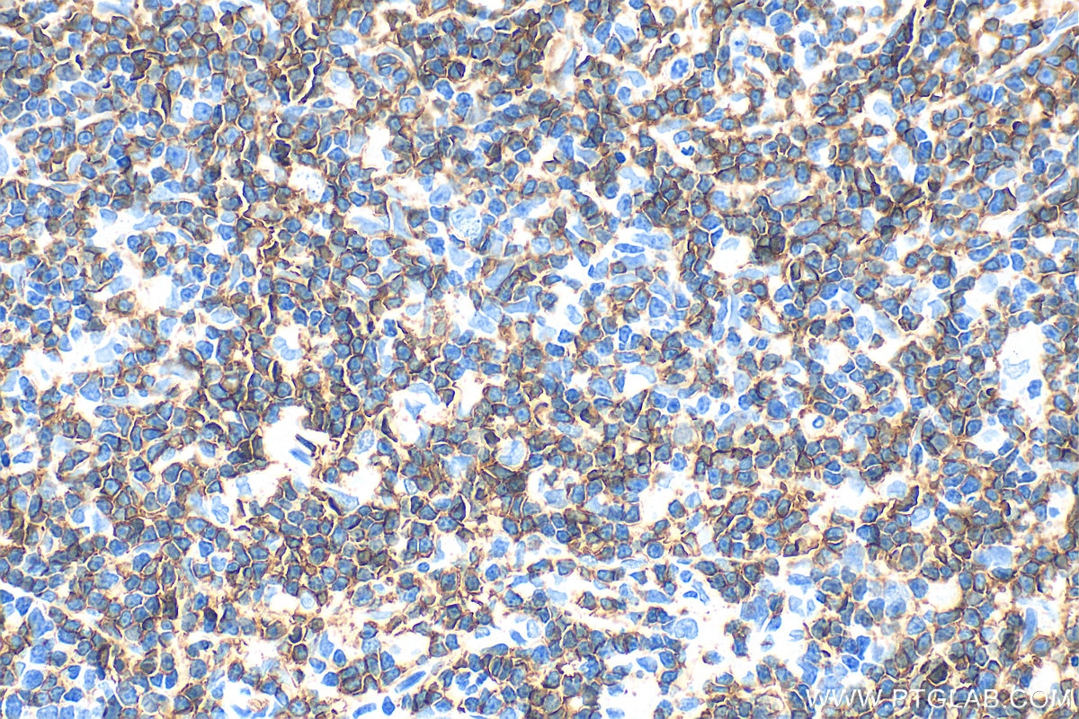 Immunohistochemistry (IHC) staining of rat thymus tissue using CD4 Polyclonal antibody (32406-1-AP)
