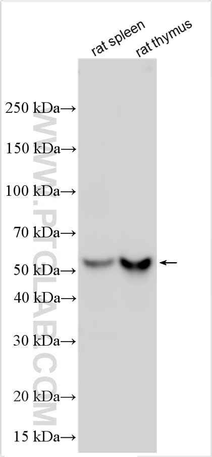 Western Blot (WB) analysis of various lysates using CD4 Polyclonal antibody (32406-1-AP)