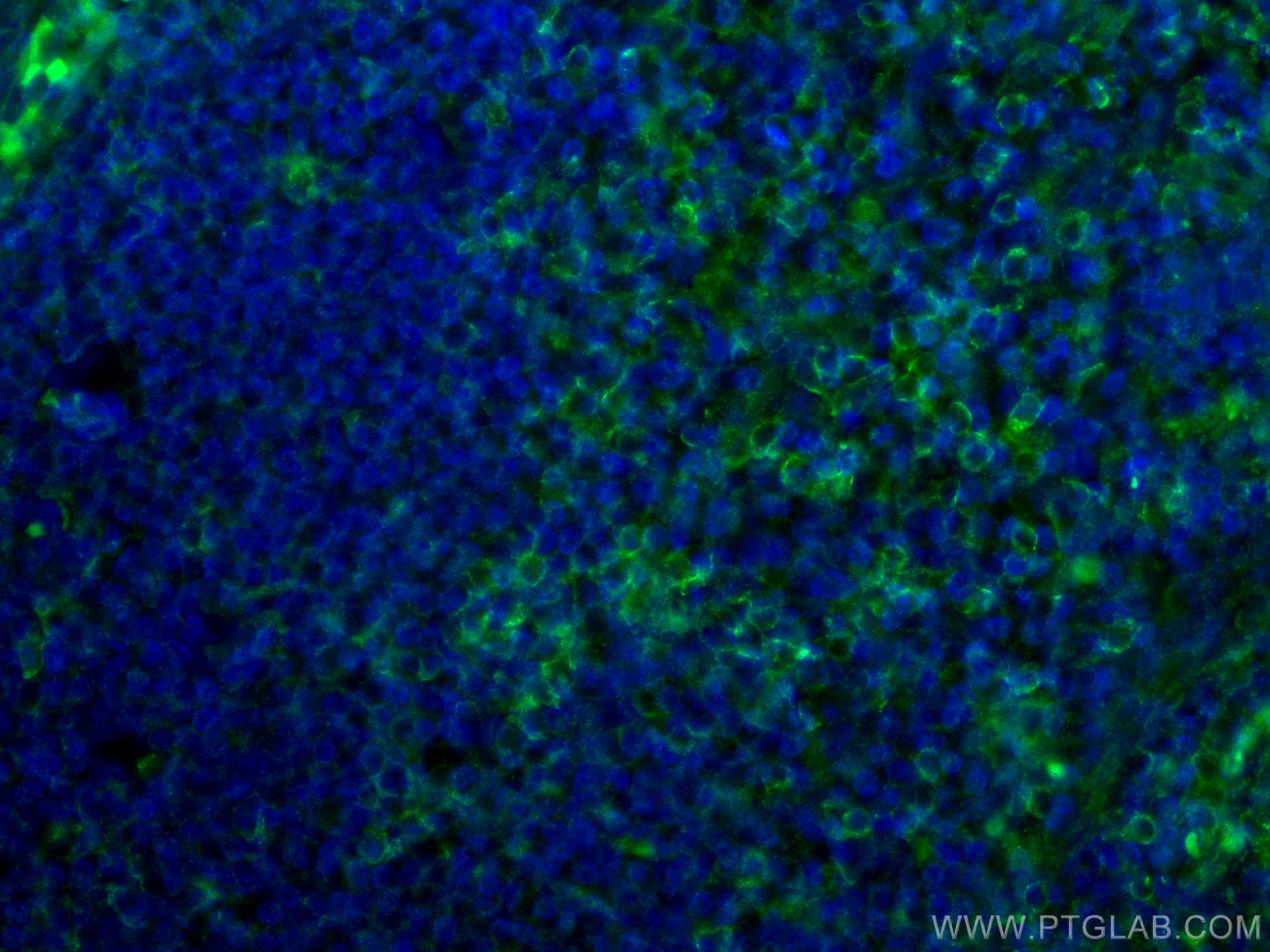 Immunofluorescence (IF) / fluorescent staining of human tonsillitis tissue using CD4 Monoclonal antibody (67786-1-Ig)