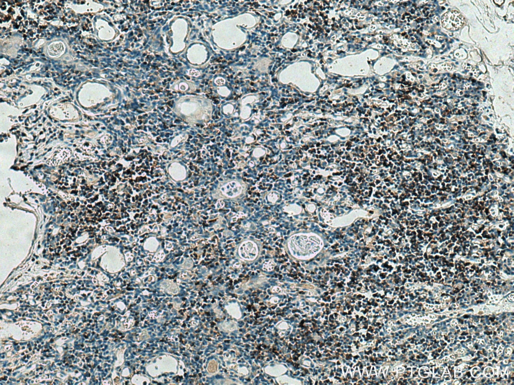 Immunohistochemistry (IHC) staining of human thymus tissue using CD4 Monoclonal antibody (67786-1-Ig)