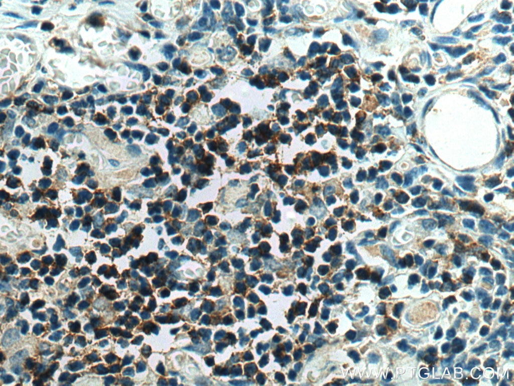 Immunohistochemistry (IHC) staining of human thymus tissue using CD4 Monoclonal antibody (67786-1-Ig)