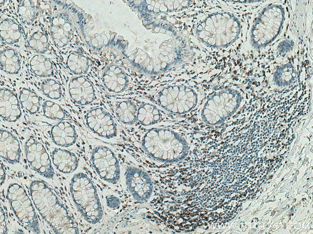 Immunohistochemistry (IHC) staining of human colon tissue using CD4 Monoclonal antibody (67786-1-Ig)