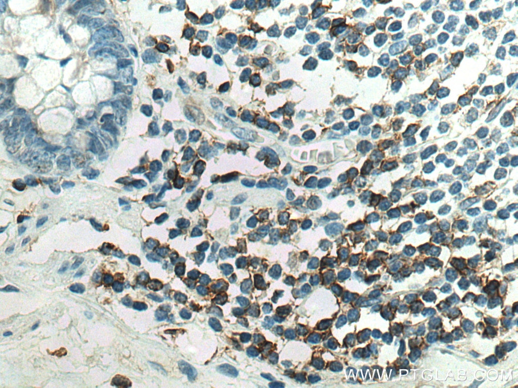 IHC staining of human colon using 67786-1-Ig