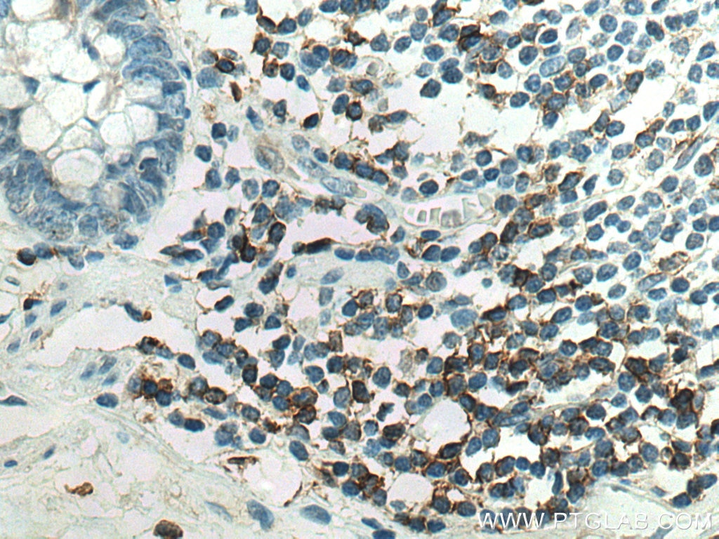 Immunohistochemistry (IHC) staining of human colon tissue using CD4 Monoclonal antibody (67786-1-Ig)