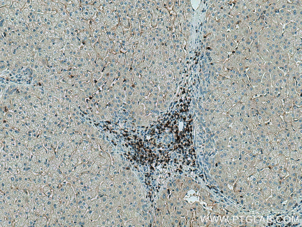 Immunohistochemistry (IHC) staining of human liver tissue using CD4 Monoclonal antibody (67786-1-Ig)