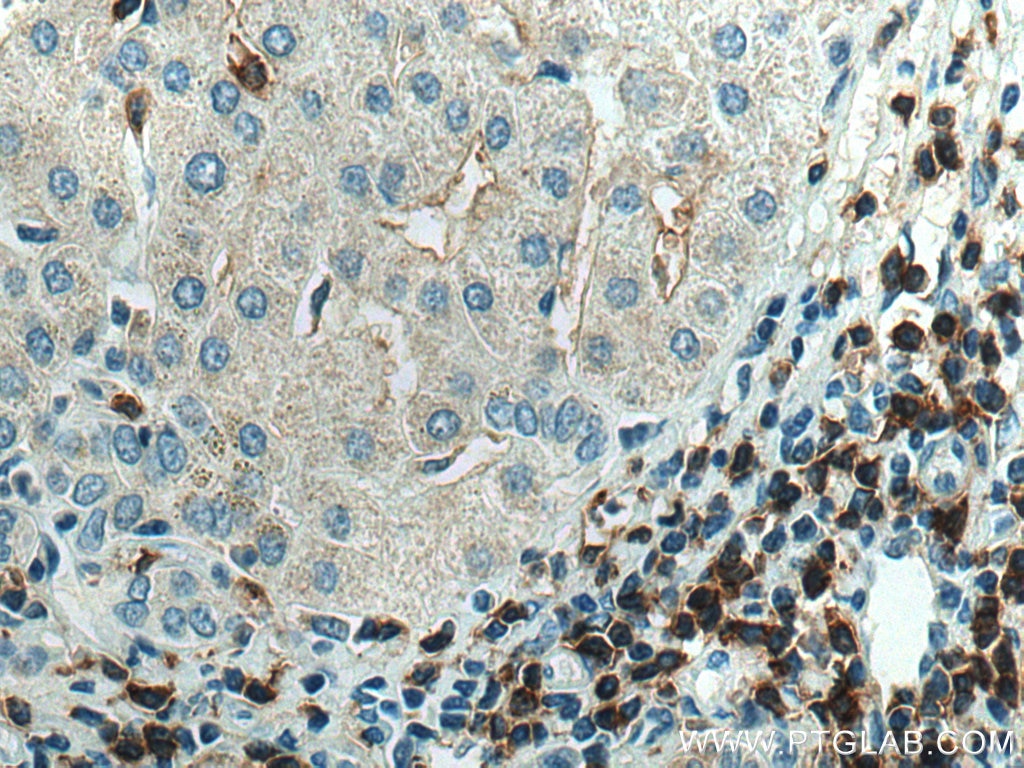 Immunohistochemistry (IHC) staining of human liver tissue using CD4 Monoclonal antibody (67786-1-Ig)