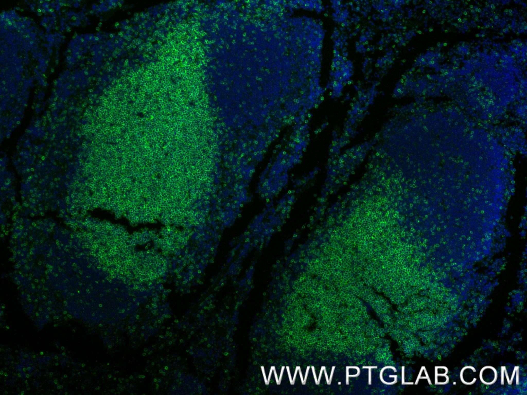 Immunofluorescence (IF) / fluorescent staining of mouse spleen tissue using CD4 Recombinant monoclonal antibody (86300-3-RR)