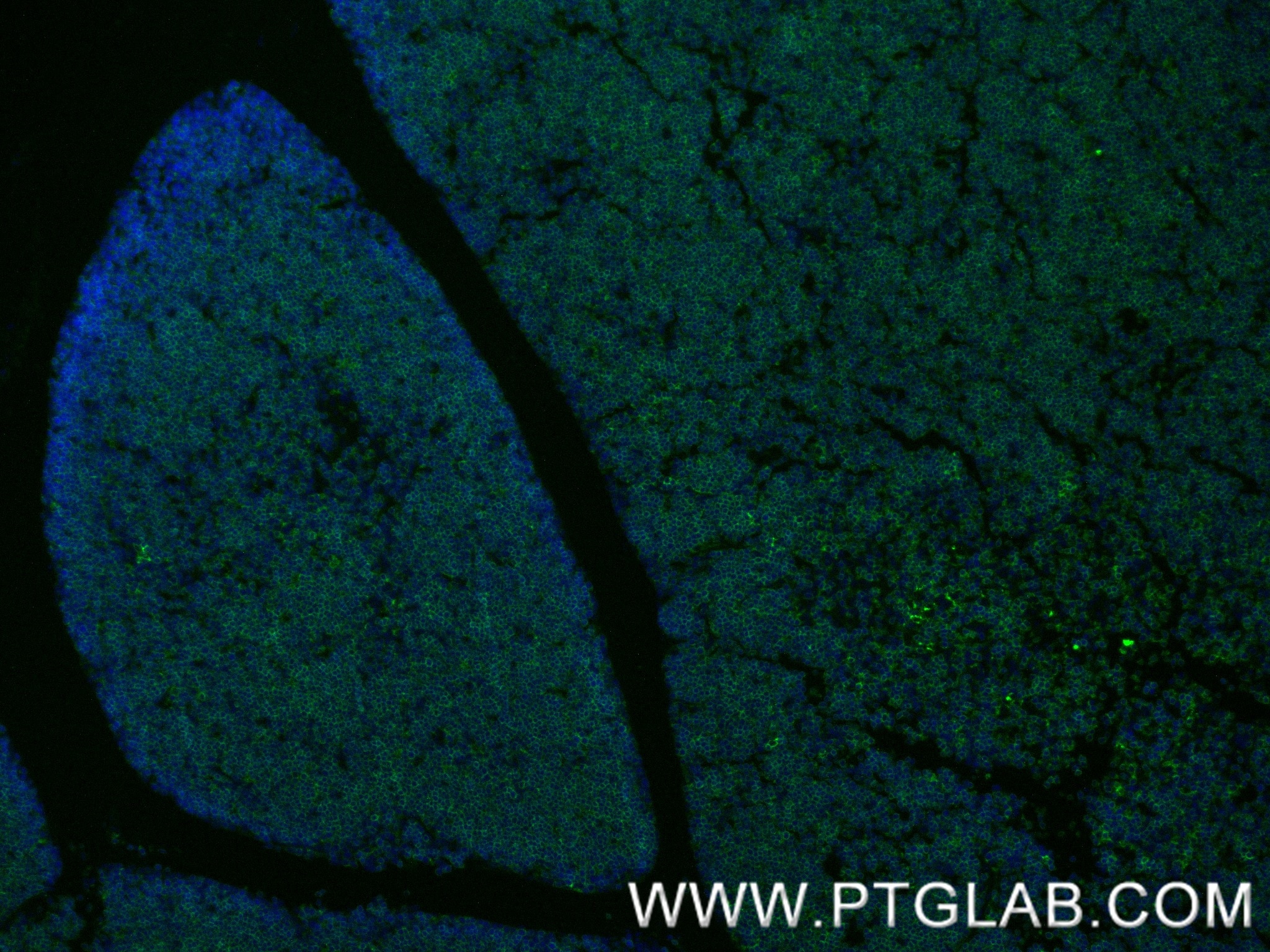 Immunofluorescence (IF) / fluorescent staining of mouse thymus tissue using CD4 Recombinant monoclonal antibody (86300-3-RR)