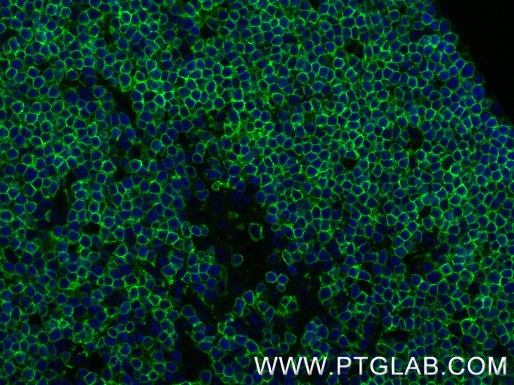 Immunofluorescence (IF) / fluorescent staining of mouse thymus tissue using CD4 Recombinant monoclonal antibody (86300-3-RR)
