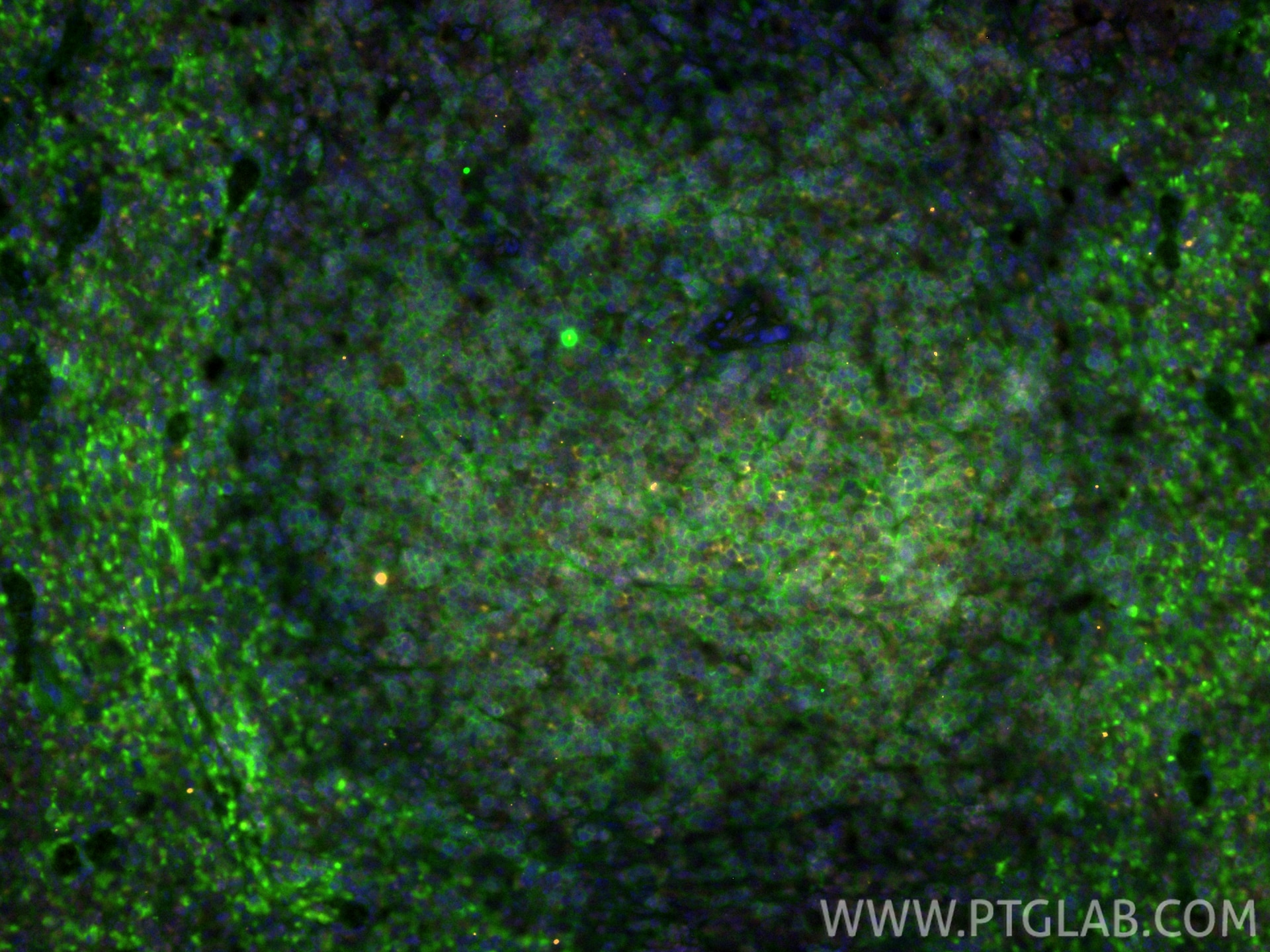 Immunofluorescence (IF) / fluorescent staining of mouse spleen tissue using CD4 Recombinant monoclonal antibody (86300-3-RR)
