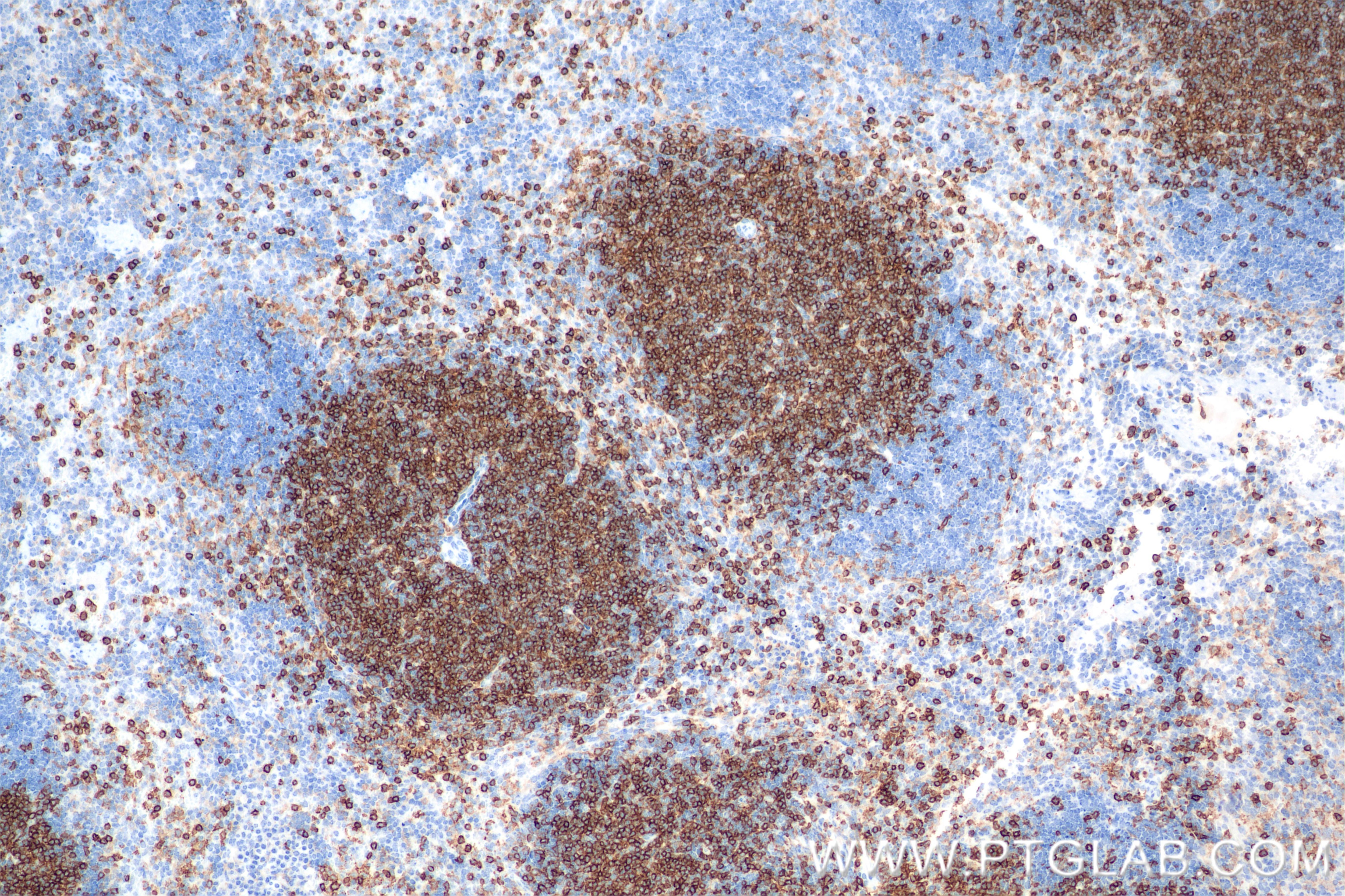 Immunohistochemistry (IHC) staining of mouse spleen tissue using CD4 Recombinant monoclonal antibody (86300-3-RR)