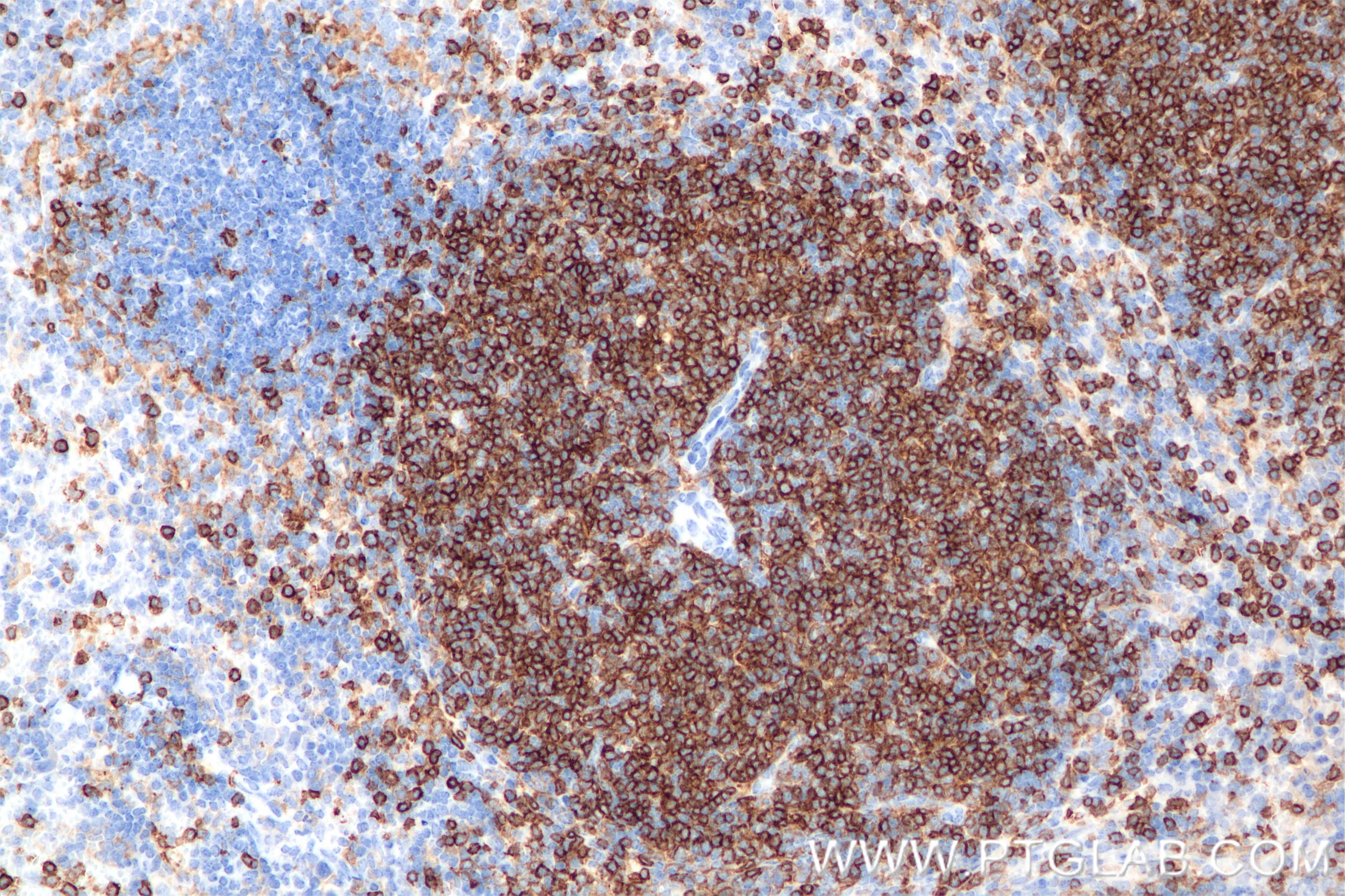 Immunohistochemistry (IHC) staining of mouse spleen tissue using CD4 Recombinant monoclonal antibody (86300-3-RR)