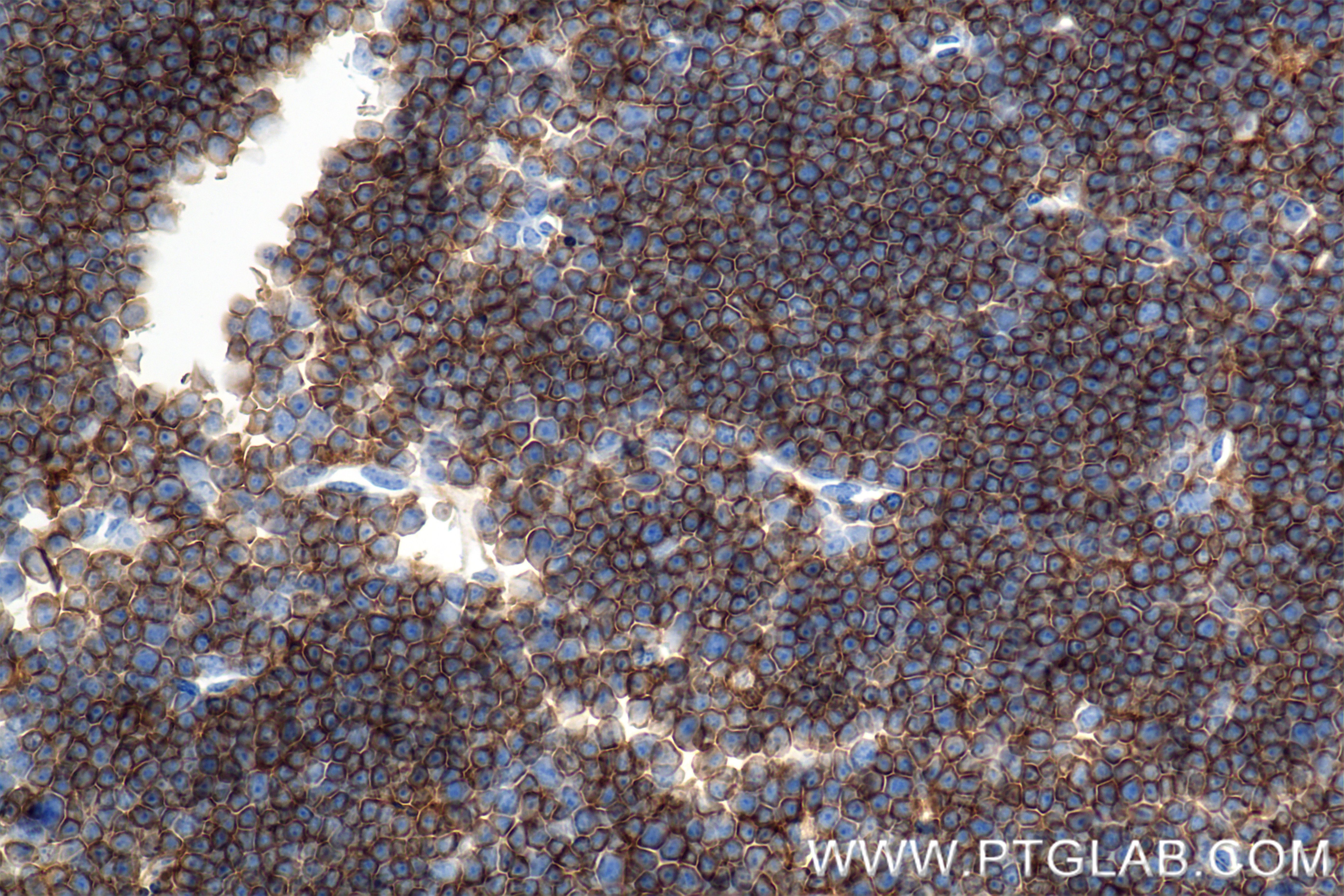 Immunohistochemistry (IHC) staining of mouse thymus tissue using CD4 Recombinant monoclonal antibody (86300-3-RR)