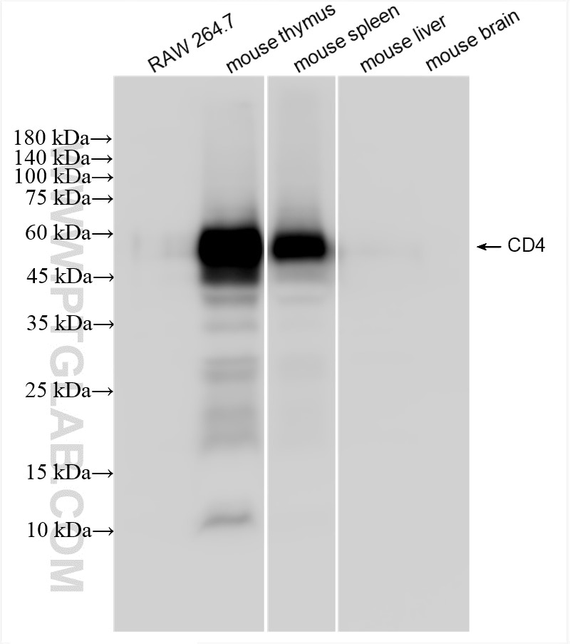 Western Blot (WB) analysis of various lysates using CD4 Recombinant antibody (86300-3-RR)