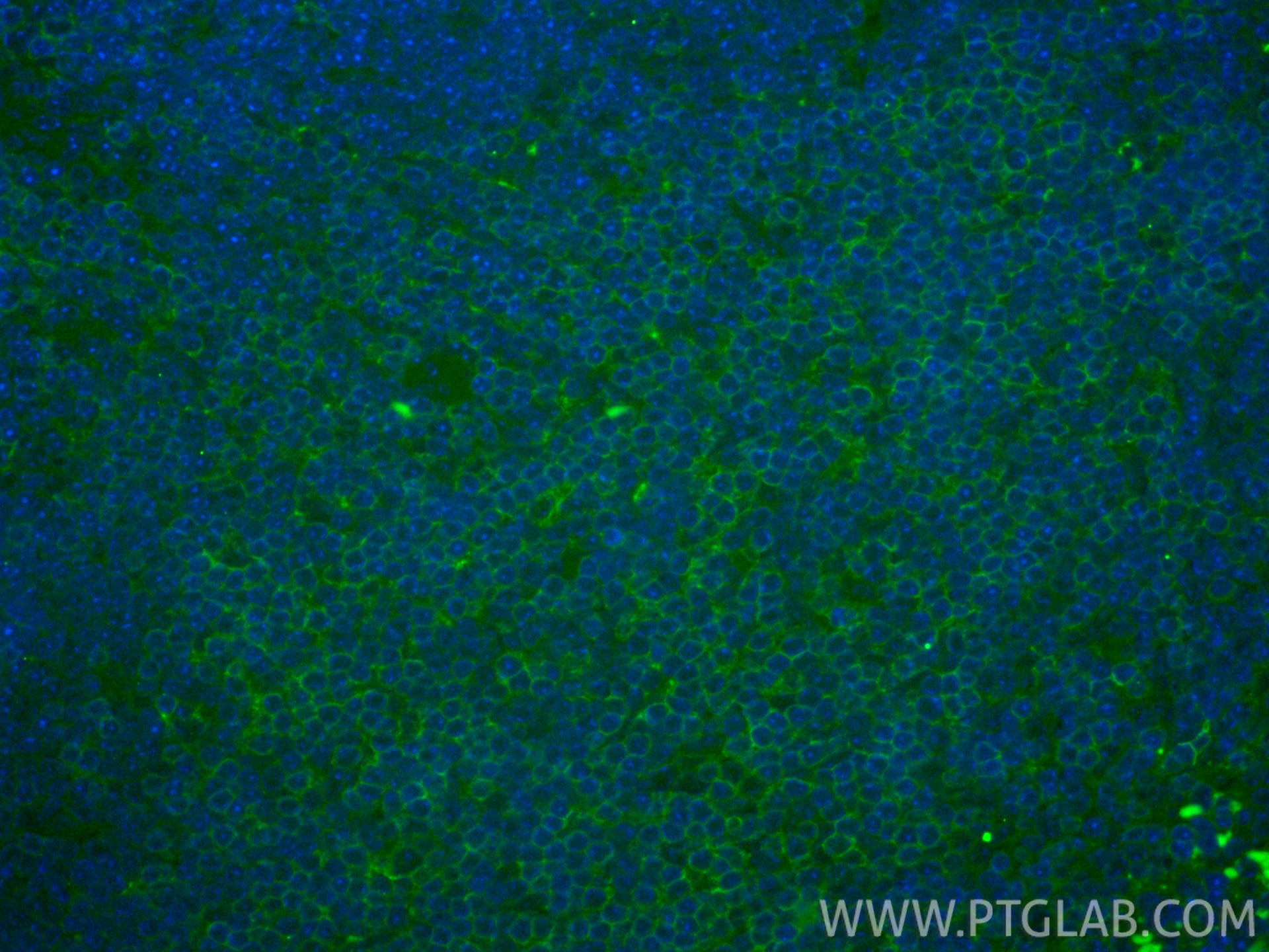 IF Staining of mouse spleen using FITC-86300-3 Immunofluorescence (IF) / fluorescent staining of mouse spleen tissue using FITC Plus-conjugated CD4 Recombinant monoclonal an (FITC-86300-3)