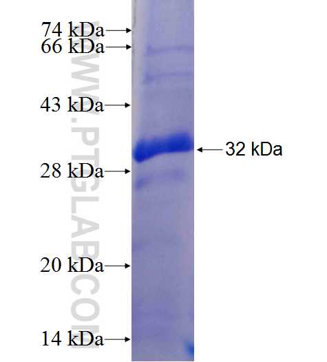 CD4 fusion protein Ag25060 SDS-PAGE