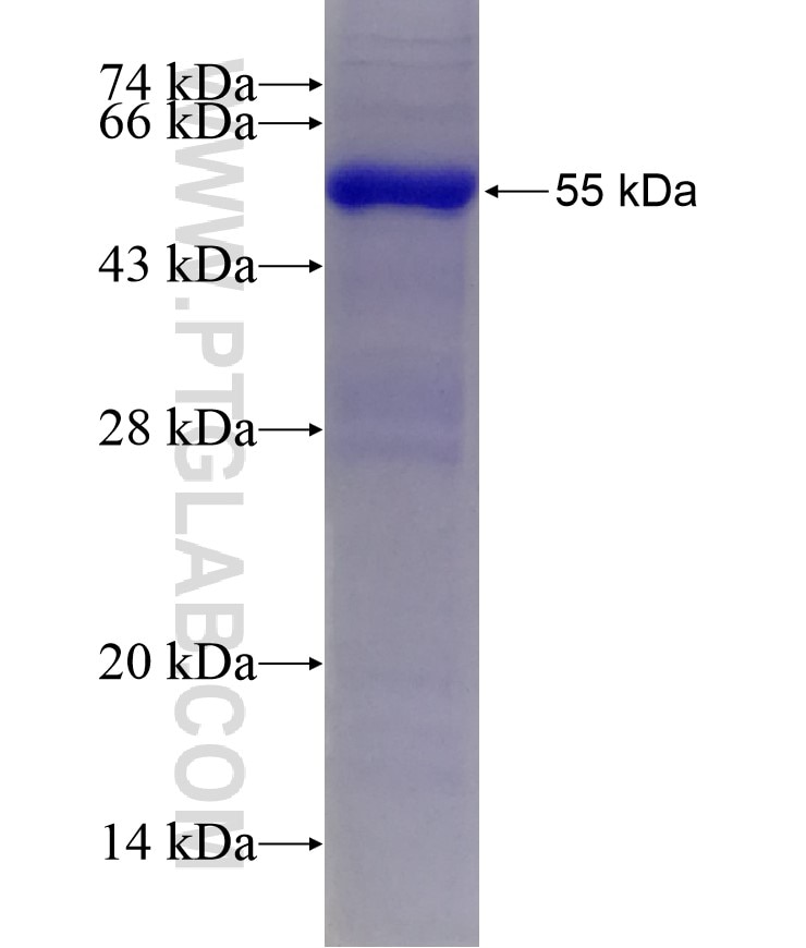 CD4 fusion protein Ag0422 SDS-PAGE