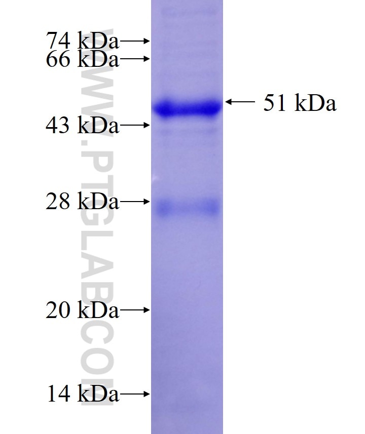 CD4 fusion protein Ag0422 SDS-PAGE