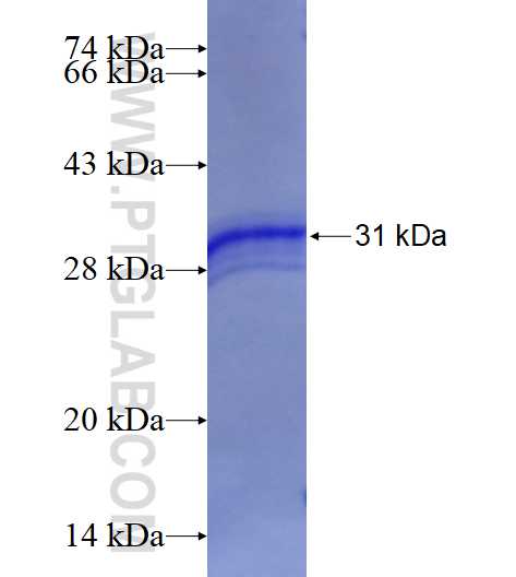 CD4 fusion protein Ag13616 SDS-PAGE
