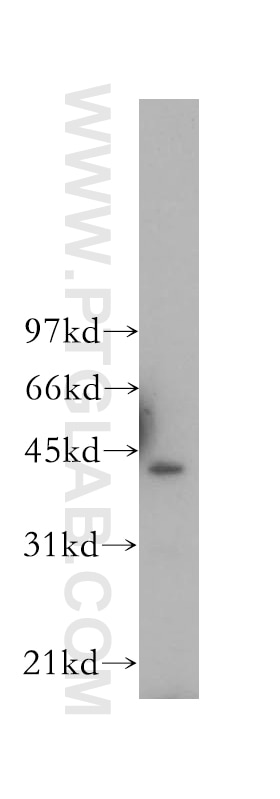 Western Blot (WB) analysis of Jurkat cells using CD40 Polyclonal antibody (12971-1-AP)