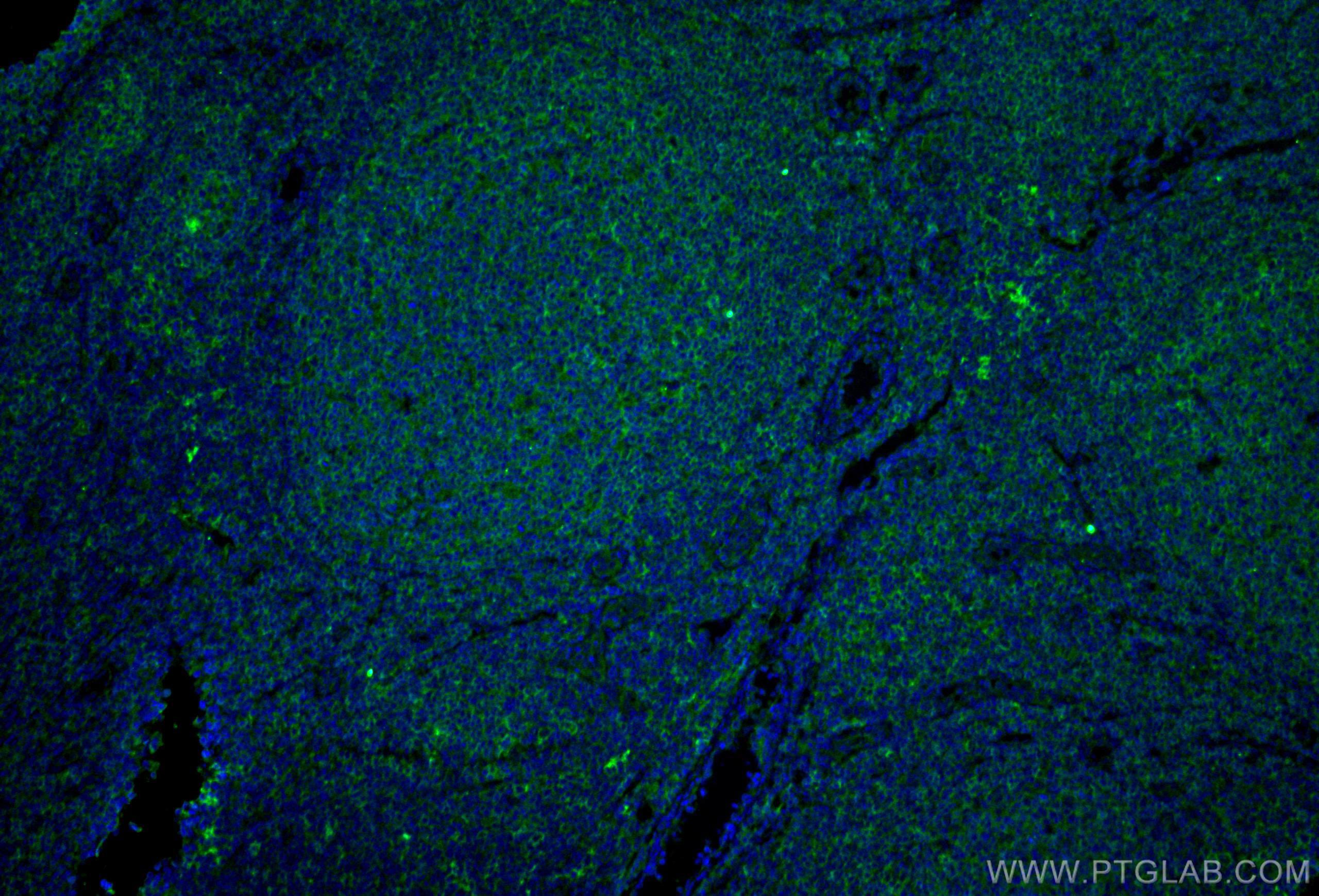 Immunofluorescence (IF) / fluorescent staining of human tonsillitis tissue using CD40 Monoclonal antibody (66965-1-Ig)