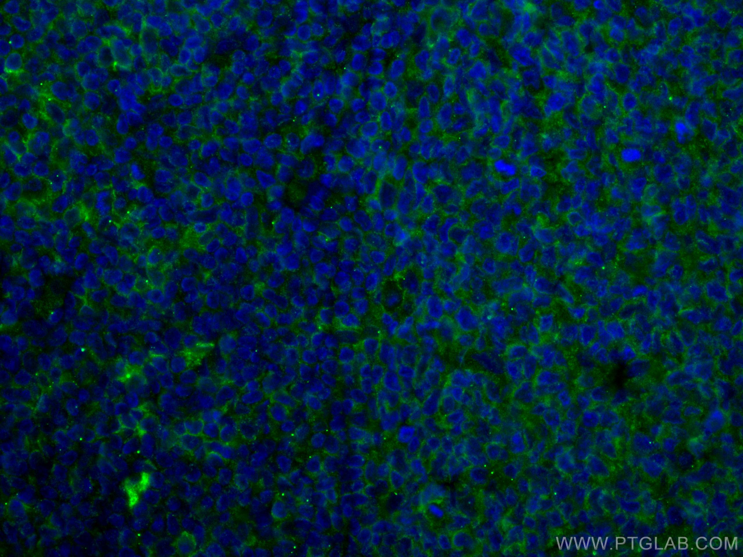 Immunofluorescence (IF) / fluorescent staining of human tonsillitis tissue using CD40 Monoclonal antibody (66965-1-Ig)