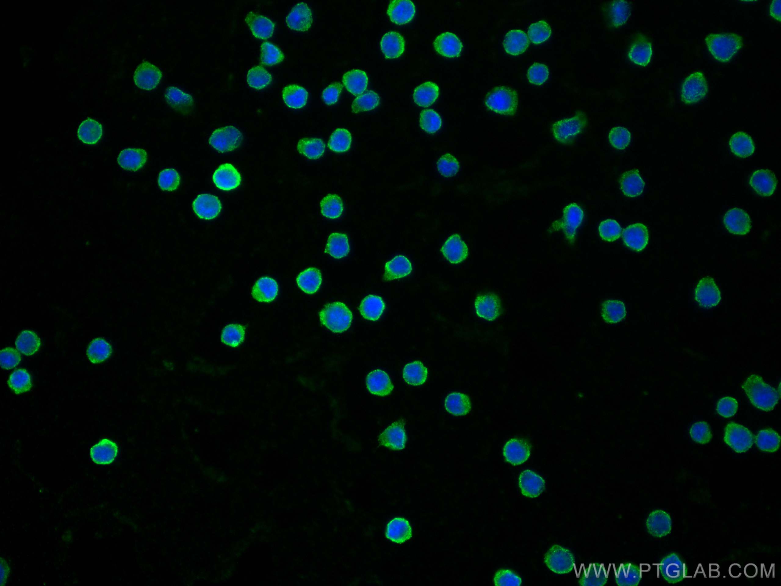 Immunofluorescence (IF) / fluorescent staining of Ramos cells using CD40 Monoclonal antibody (66965-1-Ig)
