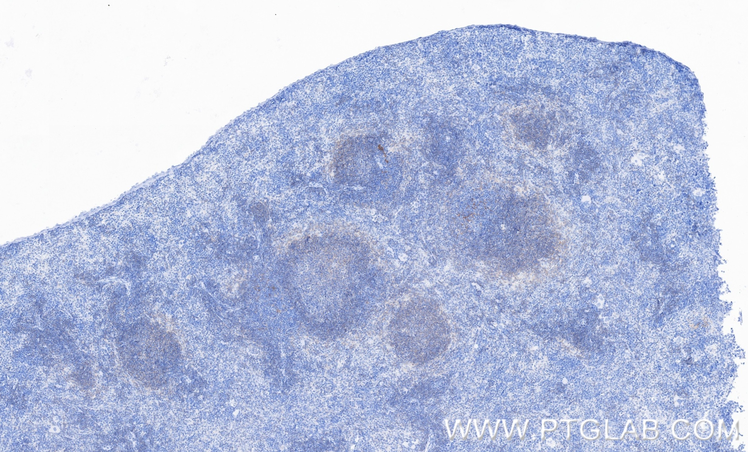 IHC staining of mouse spleen using 98122-1-RR Immunohistochemistry (IHC) staining of mouse spleen tissue using Anti-Mouse CD40 Rabbit Recombinant Antibody (98122-1-RR)
