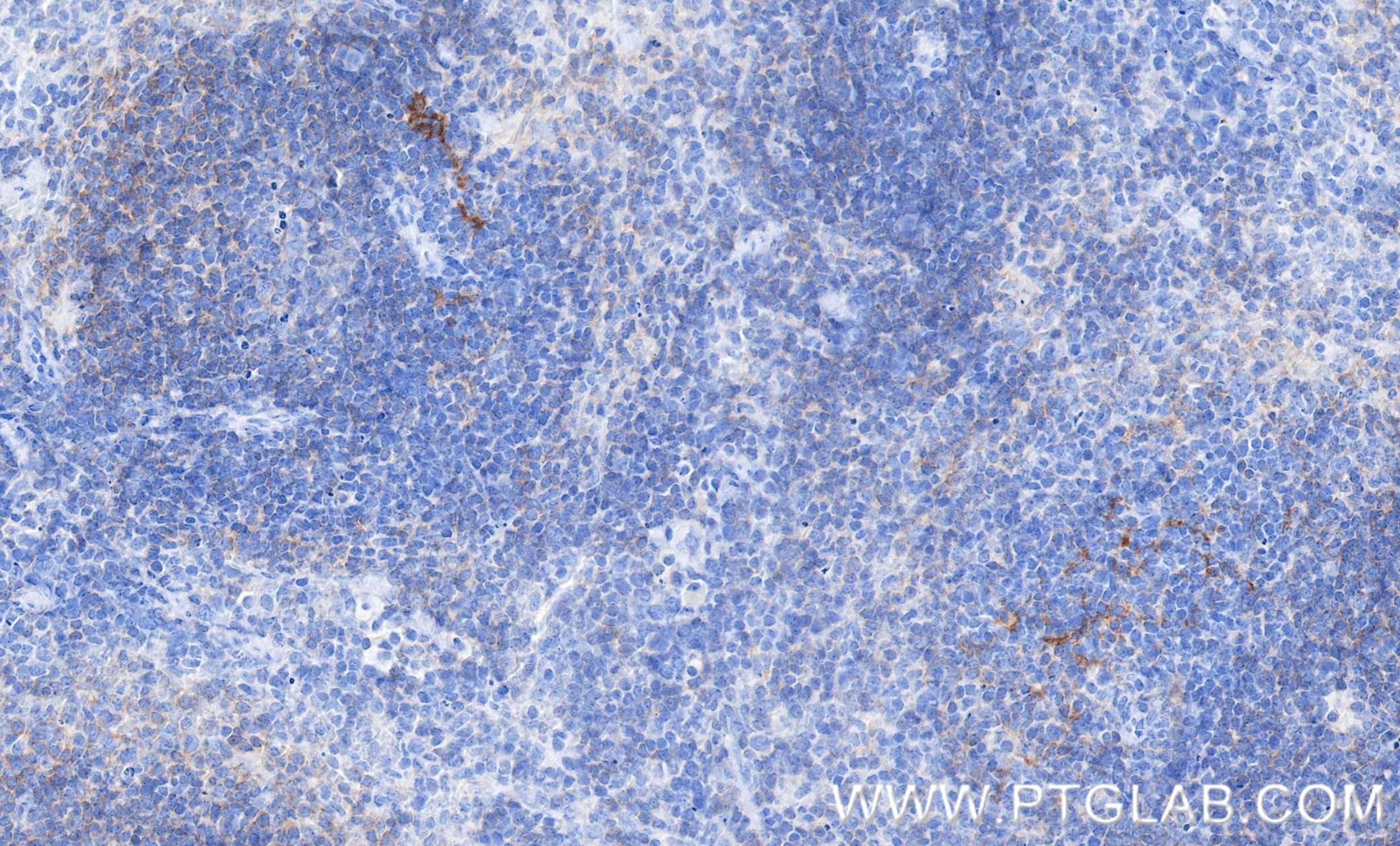 IHC staining of mouse spleen using 98122-1-RR Immunohistochemistry (IHC) staining of mouse spleen tissue using Anti-Mouse CD40 Rabbit Recombinant Antibody (98122-1-RR)