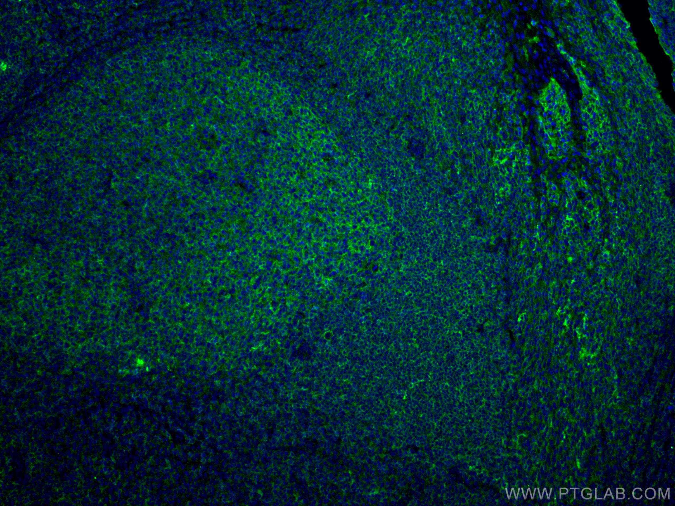 Immunofluorescence (IF) / fluorescent staining of human tonsillitis tissue using CoraLite® Plus 488-conjugated CD40 Monoclonal anti (CL488-66965)
