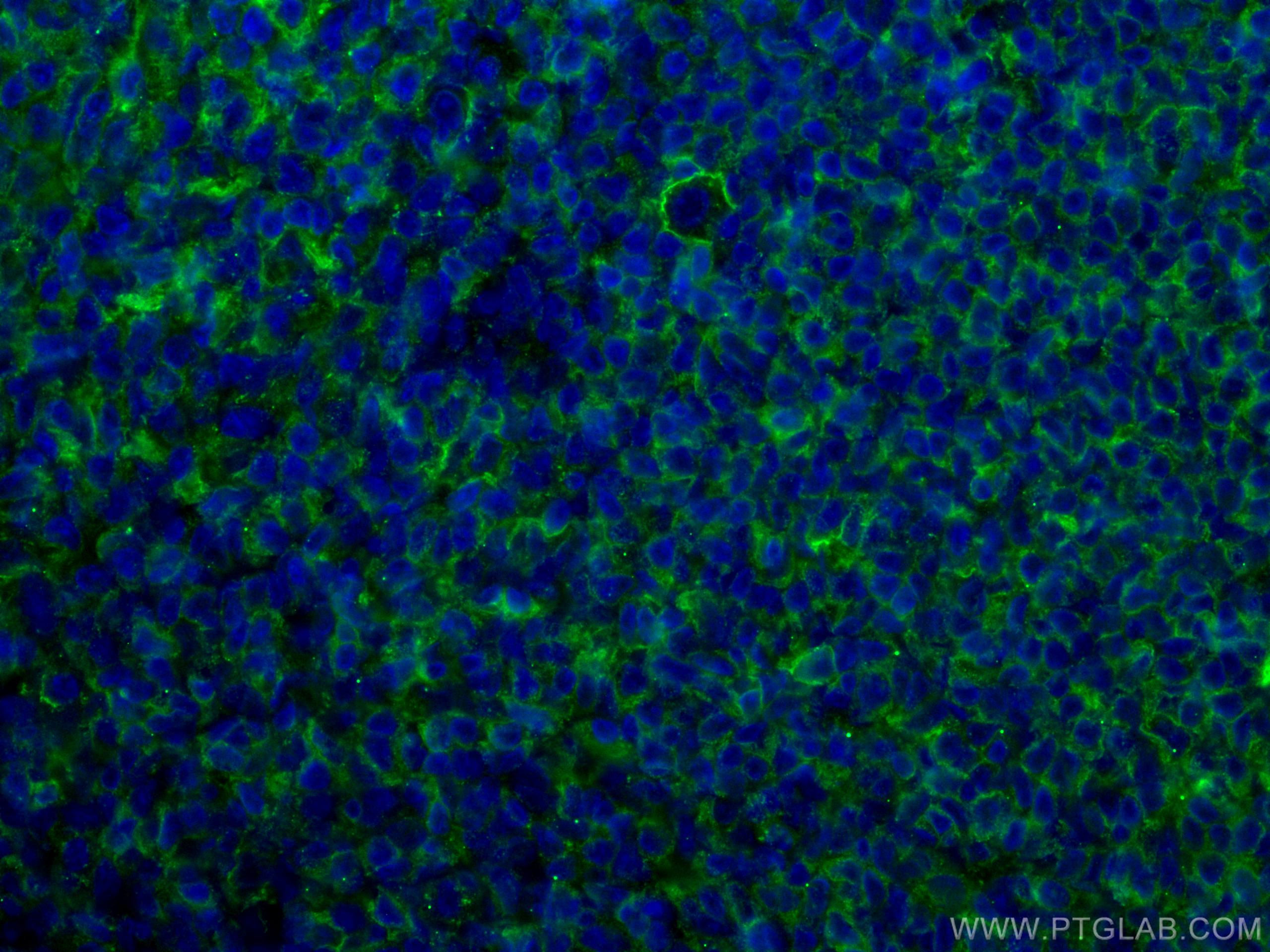 Immunofluorescence (IF) / fluorescent staining of human tonsillitis tissue using CoraLite® Plus 488-conjugated CD40 Monoclonal anti (CL488-66965)