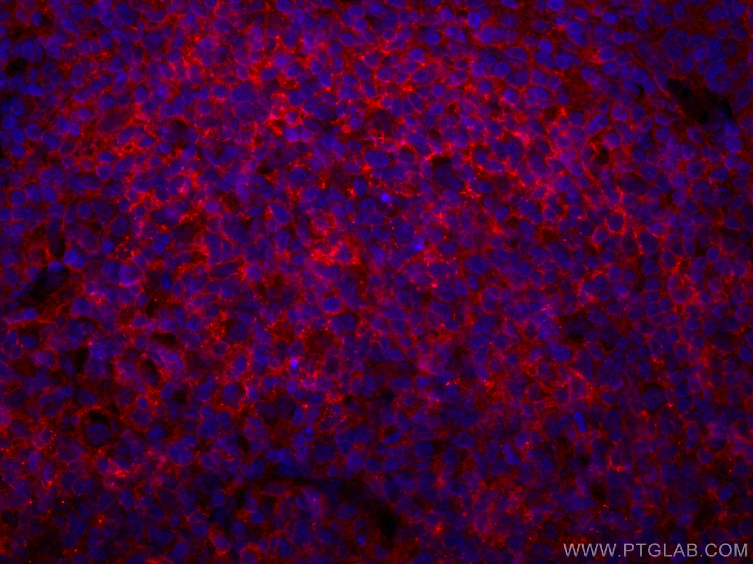 Immunofluorescence (IF) / fluorescent staining of human tonsillitis tissue using CoraLite®594-conjugated CD40 Monoclonal antibody (CL594-66965)