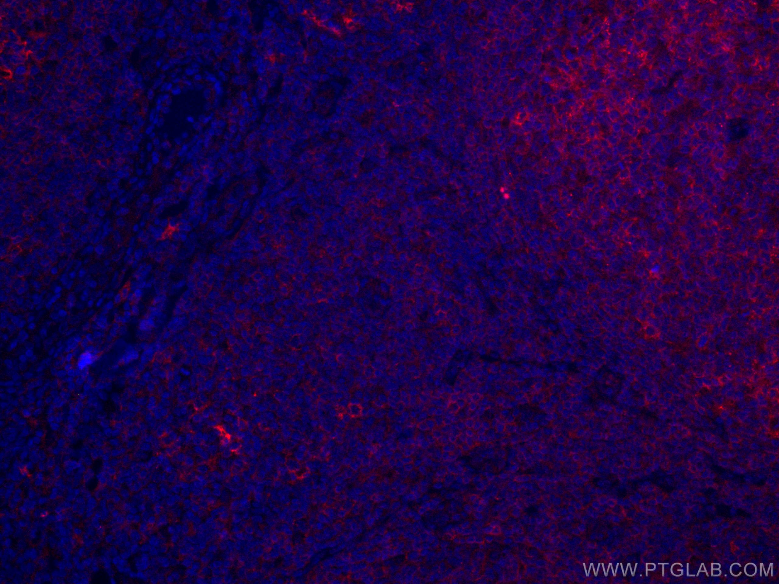 Immunofluorescence (IF) / fluorescent staining of human tonsillitis tissue using CoraLite®594-conjugated CD40 Monoclonal antibody (CL594-66965)