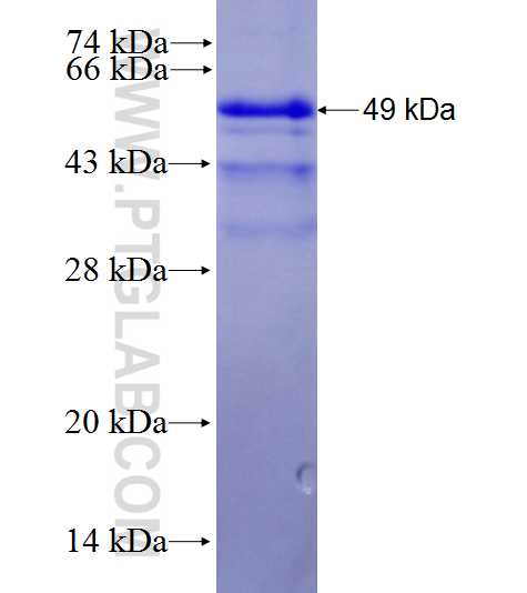 CD40 fusion protein Ag28033 SDS-PAGE