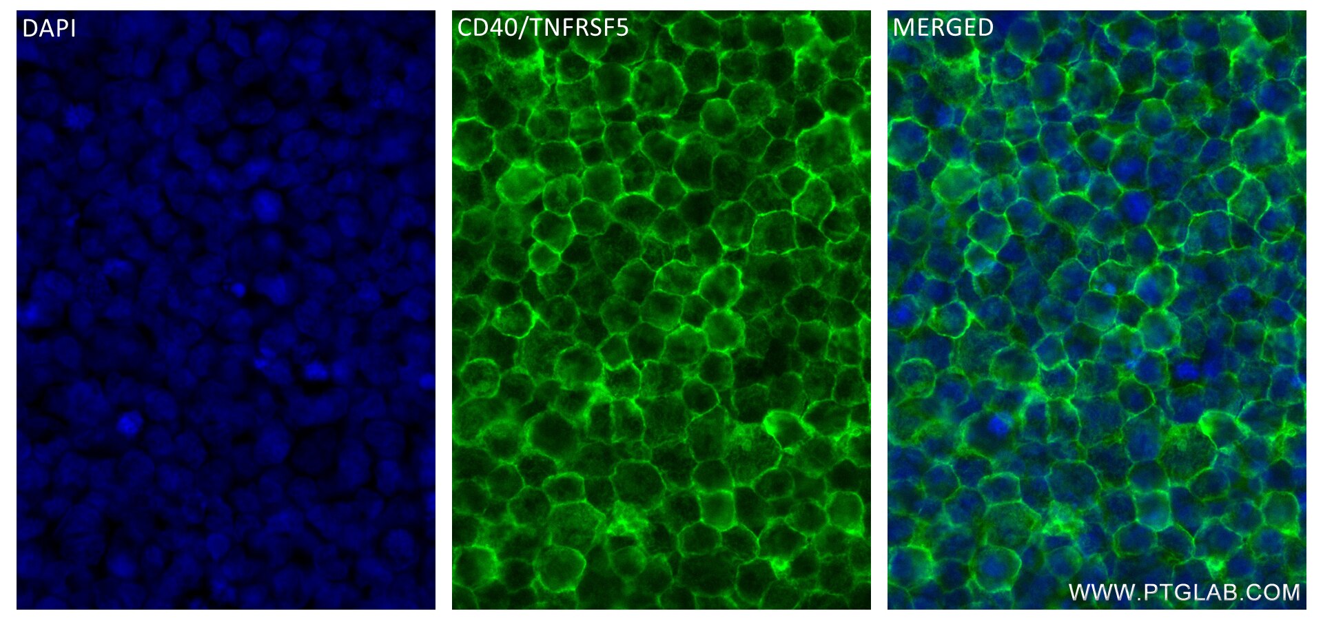 Immunofluorescence (IF) / fluorescent staining of Raji cells using CD40/TNFRSF5 Recombinant antibody (84406-2-RR)