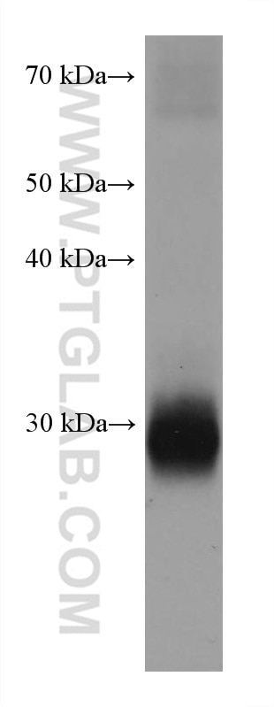 Western Blot (WB) analysis of human peripheral blood platelets using CD40L/CD154 Monoclonal antibody (66502-1-Ig)