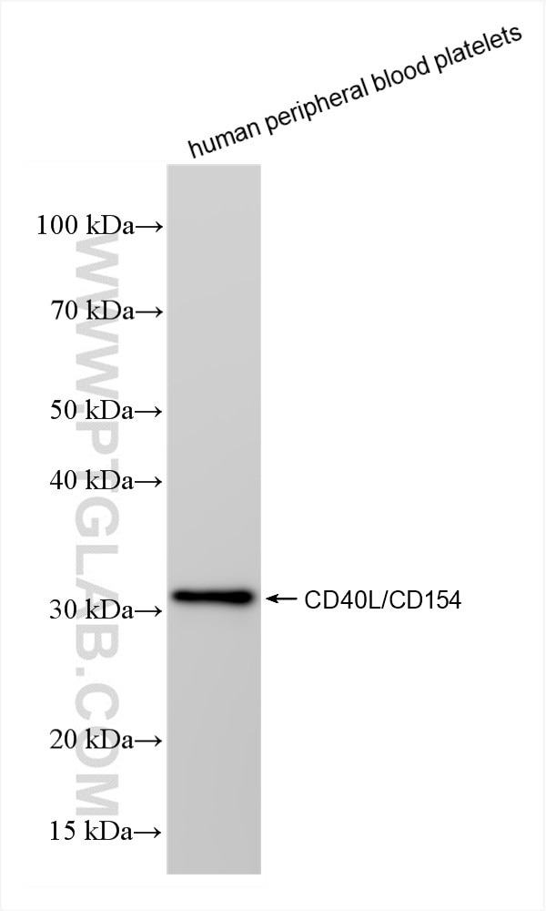 CD40L/CD154